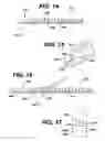 Fig. 16 - Method of inserting a feeding tube