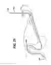 Fig. 20 - Method of inserting a feeding tube