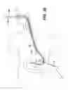 Fig. 25 - Method of inserting a feeding tube