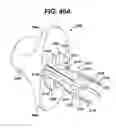 Fig. 40 - Method of inserting a feeding tube