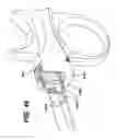 Fig. 46 - Method of inserting a feeding tube