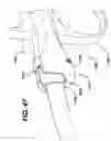 Fig. 47 - Method of inserting a feeding tube