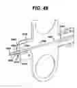 Fig. 49 - Method of inserting a feeding tube