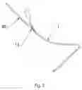 Fig. 03 - Systems and methods to facilitate endoscopic