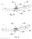 Fig. 09 - Systems and methods to facilitate endoscopic