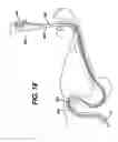 Fig. 17 - Track for medical devices