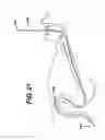 Fig. 20 - Track for medical devices