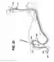 Fig. 32 - Track for medical devices