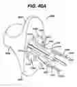 Fig. 40 - Track for medical devices