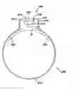 Fig. 01 - Sheath for use with an endoscope