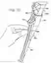 Fig. 04 - Sheath for use with an endoscope