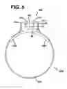 Fig. 09 - Sheath for use with an endoscope