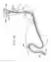 Fig. 18 - Sheath for use with an endoscope