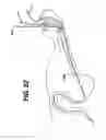 Fig. 21 - Sheath for use with an endoscope