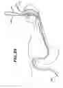 Fig. 22 - Sheath for use with an endoscope