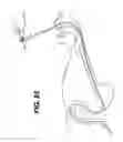 Fig. 23 - Sheath for use with an endoscope