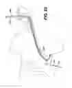 Fig. 24 - Sheath for use with an endoscope