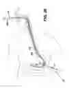 Fig. 25 - Sheath for use with an endoscope