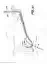 Fig. 26 - Sheath for use with an endoscope
