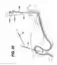 Fig. 31 - Sheath for use with an endoscope
