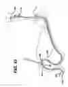 Fig. 32 - Sheath for use with an endoscope