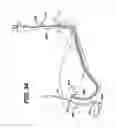 Fig. 33 - Sheath for use with an endoscope