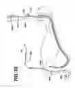 Fig. 34 - Sheath for use with an endoscope