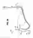 Fig. 35 - Sheath for use with an endoscope