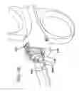 Fig. 46 - Sheath for use with an endoscope
