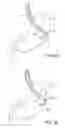 Fig. 09 - Methods and apparatus for maintaining sterility during transluminal procedures