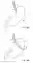 Fig. 12 - Methods and apparatus for maintaining sterility during transluminal procedures