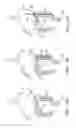 Fig. 23 - Methods and apparatus for maintaining sterility during transluminal procedures
