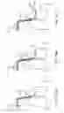 Fig. 24 - Methods and apparatus for maintaining sterility during transluminal procedures