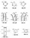 Fig. 04 - Activated polymer articulated instruments and methods of insertion