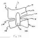 Fig. 20 - Patient interface for spectroscopy applications