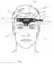 Fig. 02 - Device for use in sleep stage determination using frontal electrodes