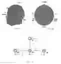 Fig. 04 - Device for use in sleep stage determination using frontal electrodes