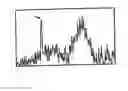 Fig. 01 - Magnetic resonance locating method