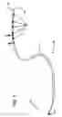 Fig. 02 - Catheter with compactly terminated electronic component