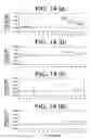 Fig. 15 - Method and apparatus for assessing vascular endothelial function