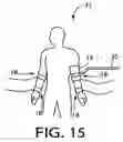 Fig. 16 - Method and apparatus for assessing vascular endothelial function