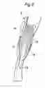 Fig. 06 - Walking assistance device
