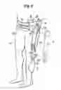 Fig. 08 - Walking assistance device