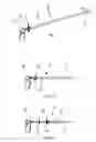 Fig. 02 - Delivery device with viewing window and associated method