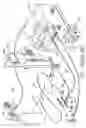 Fig. 02 - Rotational atherectomy system