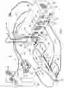 Fig. 03 - Rotational atherectomy system