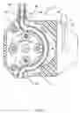 Fig. 04 - Rotational atherectomy system