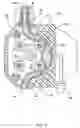 Fig. 06 - Rotational atherectomy system