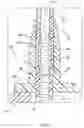 Fig. 07 - Rotational atherectomy system
