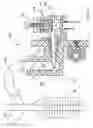 Fig. 17 - Rotational atherectomy system